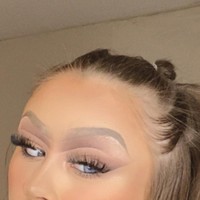 Elley pun berharap ia bisa menginspirasi orang-orang yang punya kondisi sama dengannya. Aku punya kesempatan untuk berani menunjukkan insecurity dan kondisiku dan jadi stand out, tuturnya.Foto: Instagram @elley.davies