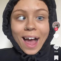 Meski postingannya jadi viral dan mendapat komentar dari influencer lain, Elley mengaku mendapat banyak komentar mengenai kondisi matanya. Kadang aku berkomentar balik dan setuju dengan komentar mereka, aku hanya ingin menunjukkan bahwa aku tidak terganggu karena aku memang tidak, kata Elley.Foto: Dok. Tiktok