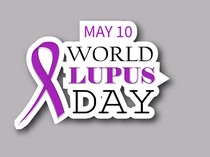 Mengenal Lupus: Penyebab, Gejala, dan Pengobatannya