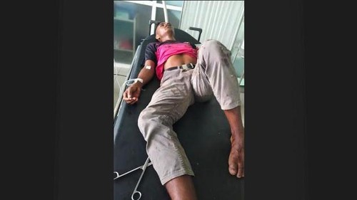 Korban bacokan, Korban Agustinus Pote (19), warga Kampung Binatana, Desa Weekokor, Kecamatan Wewewa Tengah, Kabupaten Sumba Barat Daya menjalani perawatan di RSUD Waikabubak, Minggu (8/5/2022).