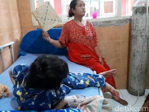 Tolong! Bocah Perempuan di Brebes Ini Sakit Kanker Mata