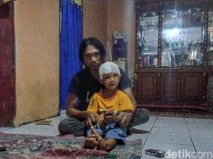 Respons Bupati Bandung Soal Bocah Terserempet Kereta Api