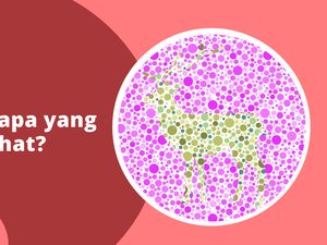 Yakin Nggak Buta Warna? Coba Tebak Hewan Ini Rusa Atau Kancil?