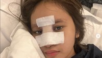 Nama Dhyaz kini tengah ramai dibicarakan terkait infeksi implan hidung yang dialaminya. Hidungnya terlihat bengkak dan implan yang belum lama ia pasang juga terpaksa diambil.