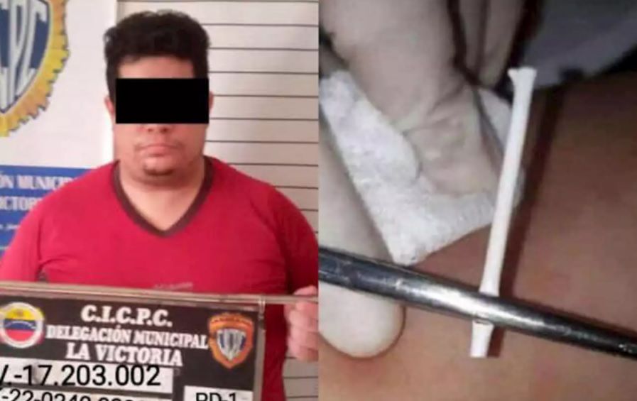 Dokter gadungan yang menanamkan stik lolipop sebagai alat kontrasepsi