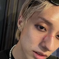 Baru-baru ini, HOLLAND memberikan kabar mengejutkan setelah diserang pria tak dikenal di kawasan Itaewon, Seoul. Wajahnya dipukuli sebanyak dua kali sebelum diserang dengan ejekan “pria gay kotor.” Foto: dok. Instagram @holland_vvv