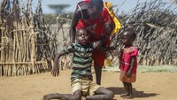 Salah satu anak Kenya yang mengalami malnutrisi. Selama berbulan-bulan, kekeringan ekstrem membuat Tanduk Afrika di ambang bencana kemanusiaan, menghancurkan tanaman dan ternak, memaksa sejumlah besar orang meninggalkan rumah mereka untuk mencari makanan dan air.