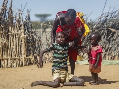 Wajah Memelas Akibat Kekeringan dan Kelaparan di Tanduk Afrika