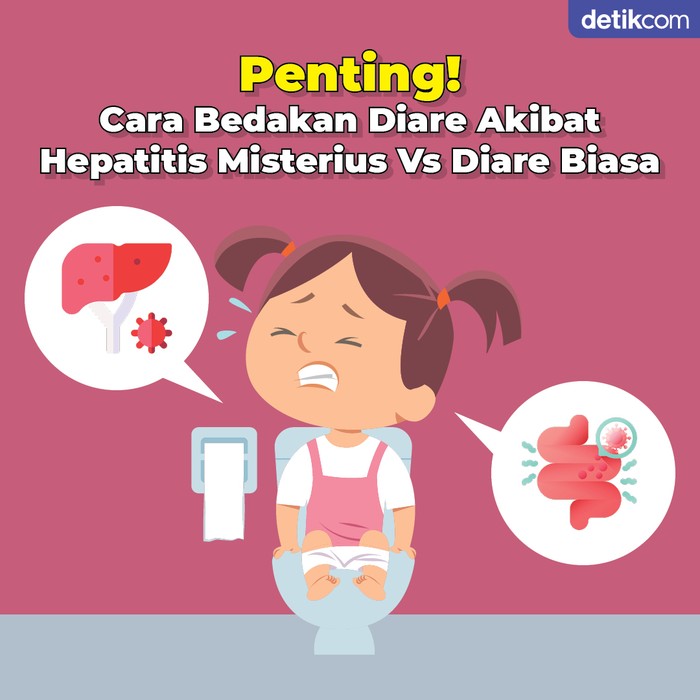 diare biasa vs hepatitis akut misterius Diare Biasa Vs Gejala Hepatitis Misterius, Begini Membedakannya