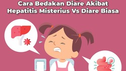 Salah satu gejala yang dilaporkan pada kasus hepatitis akut misterius adalah diare akut. Bedakah dengan diare akibat rotavirus biasa?