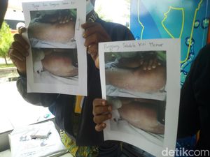 Keluarga Sebut Ada Luka di Tubuh Tersangka yang Tewas Gantung Diri