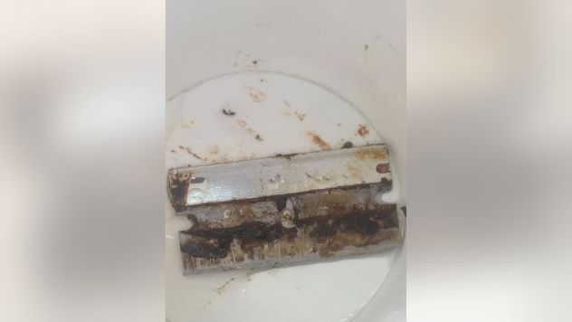 5 Temuan Paling Aneh dalam Makanan Ini Bikin Geli dan Ngeri!