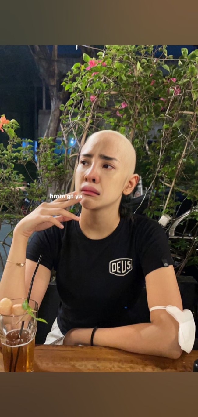 Sama-sama memiliki kepala plontos hanya saja ekspresi wajahnya tampak berbeda. Kalau dalam foto yang satu ini wajah Anya jadi terlihat seperti sedang bersedih dan akan menangis. Gimana, kamu jadi ikutan sedih atau justru jadi ingin tertawa usai melihat foto ini? Foto: Twitter/@Agha___