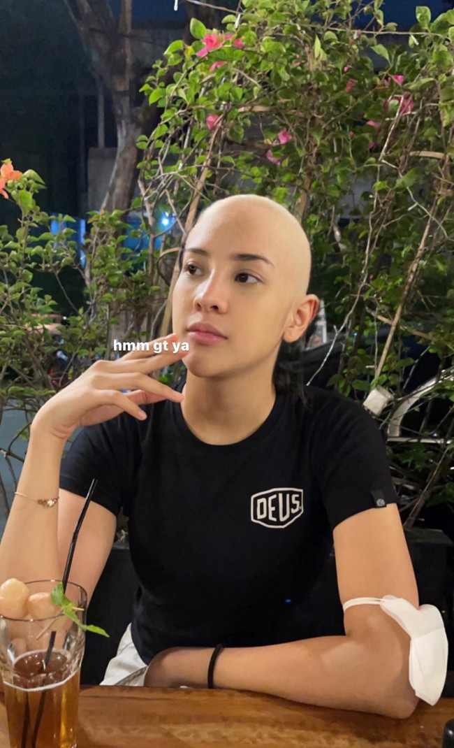 Anya Geraldine sempat menghebohkan publik karena mengunggah foto dirinya berkepala plontos. Diketahui bahwa foto tersebut hanya merupakan editan. Foto tersebutlah yang kemudian memancing para netizen untuk ikut membuat editan lucu dari foto-fotonya. Foto: Twitter/@anyaselalubenar