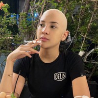 Anya Geraldine sempat menghebohkan publik karena mengunggah foto dirinya berkepala plontos. Diketahui bahwa foto tersebut hanya merupakan editan. Foto tersebutlah yang kemudian memancing para netizen untuk ikut membuat editan lucu dari foto-fotonya. Foto: Twitter/@anyaselalubenar