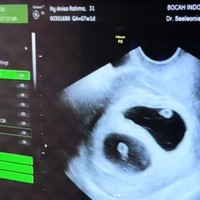 Personel grup vokal Adam Musik ini masih tidak menyangka ia dan Anisa dikaruniai anak kembar. Ia tak henti mengucapkan rasa syukur. Sejak pernikahan kami masih berusia 9 bulan, secara medis kami disebutkan sulit mempunyai buah hati secara normal.. Selama 4th ini berikhtiar dan berdoa agar harapan kami terkabulkan. Sayanggg @anisarahma_12 ..bener kan ini kita dikasih bayi kembar? masih ga nyangka Ya Allah langsung duaaa.. MasyaAllah Tabarakallah.. Sosok istri luarbiasa yang kuat @anisarahma_12 sehat selalu ya sayang..semoga Allah jaga kamu dan bayi kembar kita😭😭🤲🏻, ungkap Dito. Foto: Dok. pribadi @anisarahma_12.