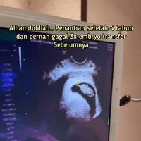 Dito pun juga meluapkan rasa bahagianya karena akan menjadi seorang bapak. Dito membuat video perjalanan proses bayi tabung di akun Instagramnya @ananditodwis. OPU (Ovum Pick Up) 31 Agustus 2021. 24 Februari 2022 menjalani frozzen embryo transfer. Ada 3 embryo yang sudah siap dimasukkan ke dalam rahim. Allahu Akbar!! Kembar MasyaAllah, tulisnya. Foto: Dok. Instagram @ananditodwis.