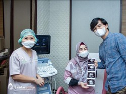 Potret Anisa Eks Cherrybelle Hamil Anak Kembar, 4 Tahun Penantian Garis Dua