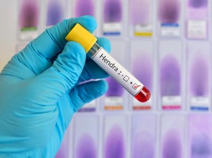 7 dari 10 Orang Terpapar Bisa Meninggal, Virus Hendra Mengintai Wilayah RI?