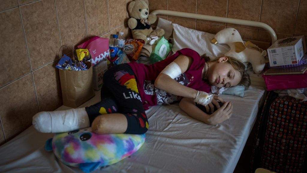 Gambaran Korban Perang Rusia-Ukraina, Sungguh Menyayat Hati