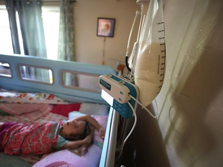 Kisah Anak Down Syndrome di AS yang Terdampak Kelangkaan Susu Formula