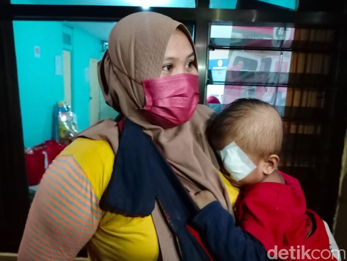 Balita yang mengalami tumor mata sejak 9 bulan silam