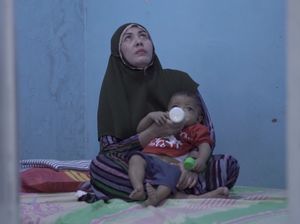 Ibu Penderita Atresia Bilier, Antara Cemas dan Senang Bisa Transplantasi Hati