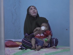 Ibu Penderita Atresia Bilier, Antara Cemas dan Senang Bisa Transplantasi Hati