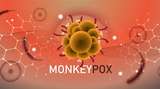 Dokter Ungkap Potensi Komplikasi Setelah Terinfeksi Cacar Monyet