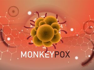 Anggota DPR Minta Pemerintah Tak Anggap Enteng Mpox: Belajar dari Covid