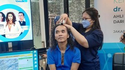 Berambut Gondrong, Kaka Slank Melakukan Transplantasi Rambut