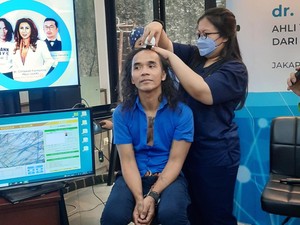 Berambut Gondrong, Kaka Slank Melakukan Transplantasi Rambut