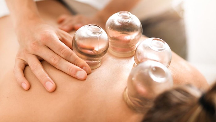 Detail of a woman therapist hands giving cupping treatment on back.