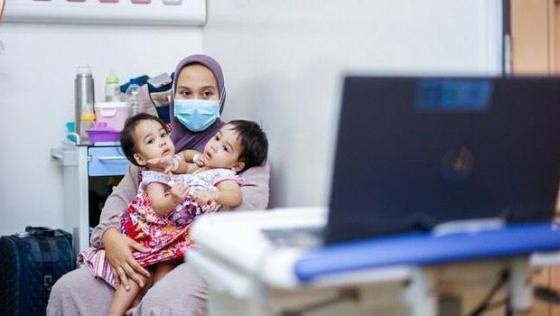 Bayi kembar siam asal Sukabumi.