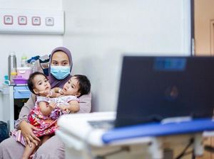 Bayi Kembar Siam Zahira-Zaina Pulih, Pulang Pekan Ini