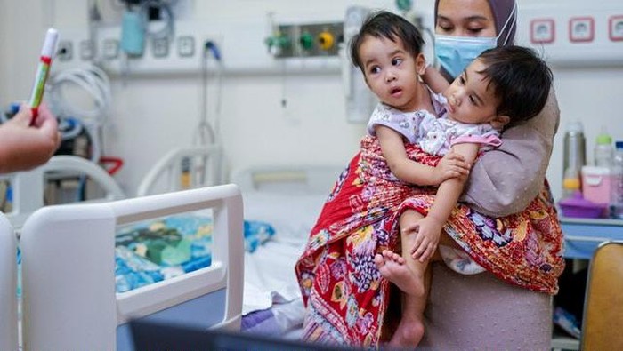 Bayi kembar siam asal Sukabumi.