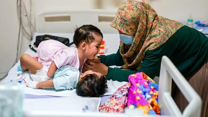 Bayi kembar siam asal Sukabumi.
