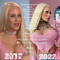 Dan inilah penampilan before after-nya. Dulu dan sekarang seperti dua orang yang berbeda karena dia terlalu mengubah kontur wajahnya. Foto: dok. Instagram