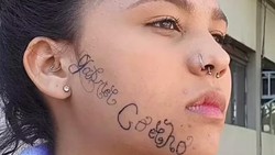 Kasihan, Kisah Remaja Diculik, Dipaksa Tato Nama Mantan Pacar di Wajahnya