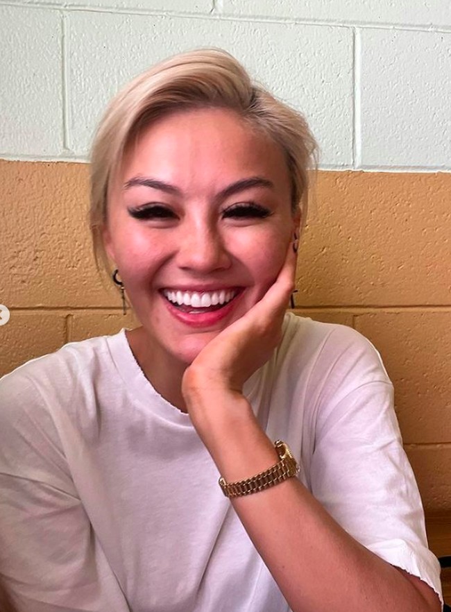 Agnez selama ini seringkali digosipkan telah melakukan operasi plastik. Namun dengan foto selfienya tanpa makeup tersebut, netizen memuji bahwa wajah Agnez masih terlihat sama seperti dulu. “Tertampar yang bilang agnez mo oplas, kini dia menjawab dengan sempurnah, cantik alami no makeup, no filter,” tulis netizen lainnya. Foto: dok. Instagram