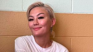 7 Foto Wajah Asli Agnez Mo Tanpa Makeup, Sering Digosipin Oplas