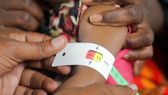 Internally displaced Somali women carry their children as they wait for malnutrition screening at the Dollow hospital in Dollow, Gedo Region, Somalia May 24, 2022. Picture taken May 24, 2022. REUTERS/Feisal Omar