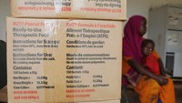 Gizi buruk masih menghantui anak-anak di Somalia akibat musibah kelaparan di negara tersebut.