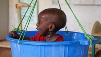 Hassan Mukhtar Mohamed, seorang anak Somalia berusia satu tahun ditimbang berat badannya di sebuah rumah sakit di Dollow, Gedo, Somalia, 24 Mei lalu.