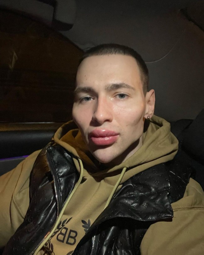 Kirill sendiri dengan bangga mengatakan wajahnya mirip dengan alien. Menurutnya dengan begitu ia akan lebih mudah untuk bertemu alien ketika meninggal. Obsesi barunya ini berawal ketika Kirill melihat piring terbang.Foto: Instagram @ruki_bazuki_official