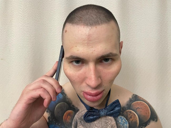 Aku merasa ketika aku meninggal, aku akan bertemu mereka. Aku percaya ini. Transformasi ketiga wajahku sudah lengkap dengan sukses. Betapa indahnya. Semuanya dilakukan seperti yang seharusnya, katanya dilansir Daily Star.Foto: Instagram @ kirilltereshin96