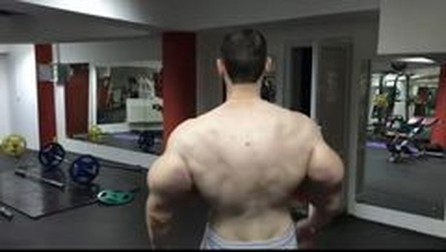 Kirill pun masih memiliki otot menggelembung seperti Popeye hasil suntikan petroleum jelly. Ia mengatakan akan melakukan operasi tahun ini untuk mengambil tumpukan jelly yang mengeras dan otot mati di bisepnya. Foto: Instagram @ kirilltereshin96