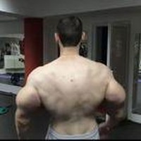 Kirill pun masih memiliki otot menggelembung seperti Popeye hasil suntikan petroleum jelly. Ia mengatakan akan melakukan operasi tahun ini untuk mengambil tumpukan jelly yang mengeras dan otot mati di bisepnya. Foto: Instagram @ kirilltereshin96