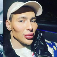 Seorang mantan tentara Rusia bernama Kirill Tereshin sempat bikin heboh karena melakukan pembesaran otot dengan cara yang tidak sehat. Ia menyuntikkan tiga liter petroleum jelly agar tangannya kekar bak Popeye. Kini Kiril memiliki obsesi baru yakni ingin bertransformasi jadi alien.Foto: Instagram @ kirilltereshin96