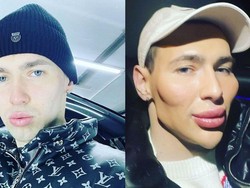 8 Foto Transformasi Mantan Tentara Rusia, Dulu Bak Popeye Kini Jadi Alien